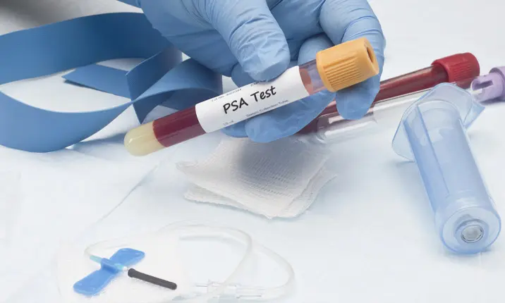 Detect prostate cancer PSA test