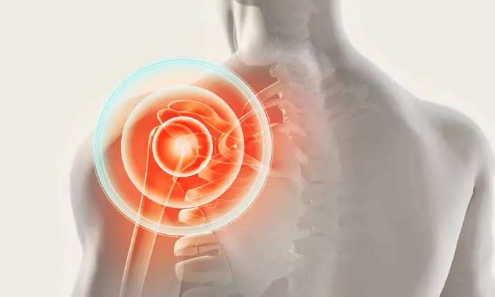 Torn Rotator Cuff Treatment & Surgery in Singapore