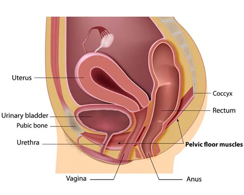 Pelvic organ prolapse or POP occurs when the pelvic organs drop from their original position in the pelvis