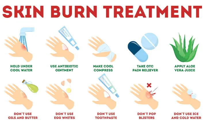Burns treatment