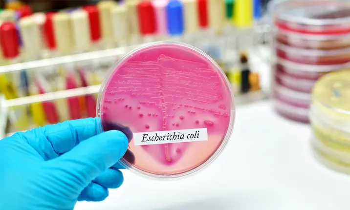Prenatal infection - E coli