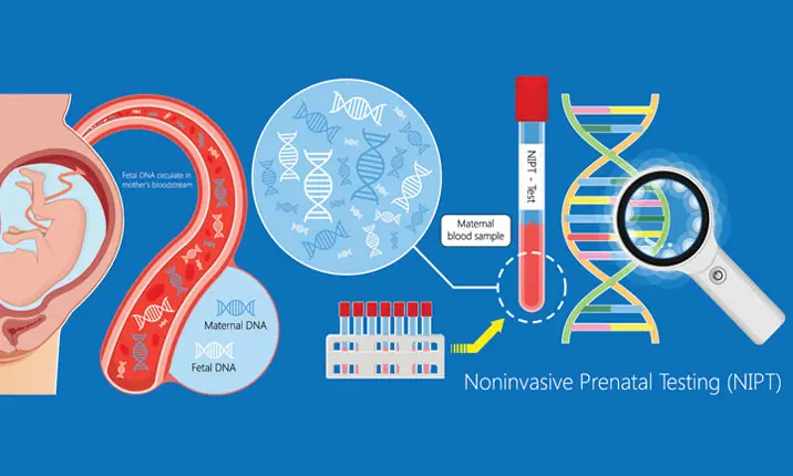 Noninvasive Prenatal Testing