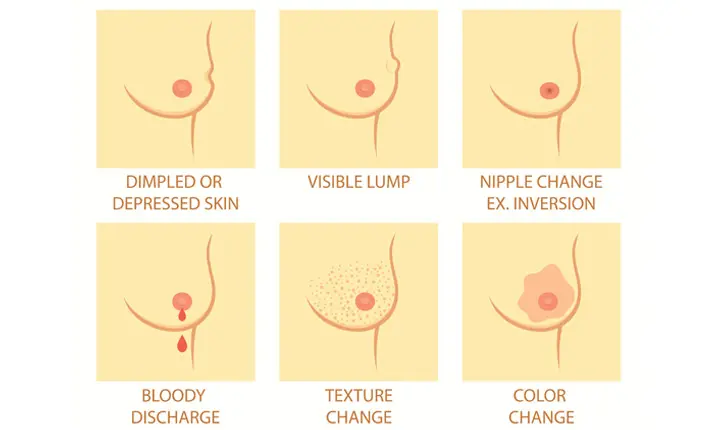 Breast screening reasons