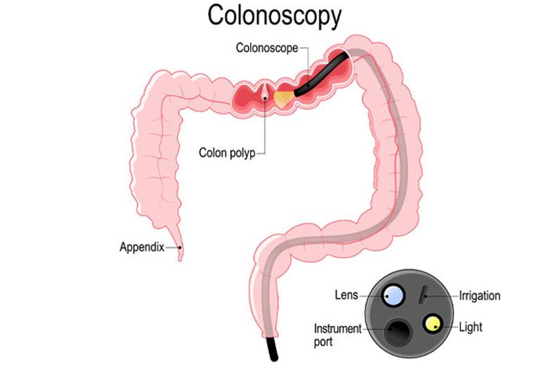 Colonoscopy. Inside of Healthy Colon, Large Intestine Stock