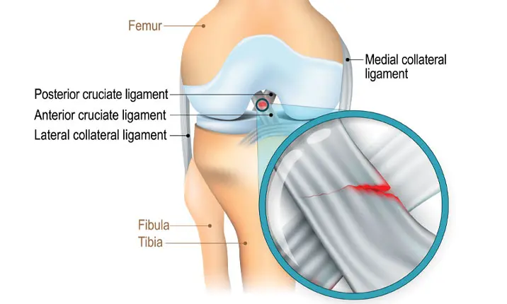 How Long Does a Sports Injury Take to Heal?