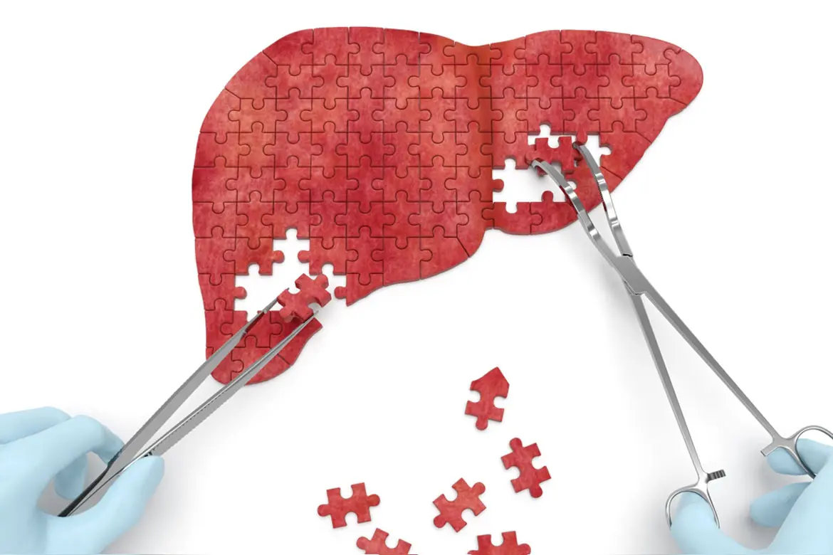 Is My Liver Abnormal?