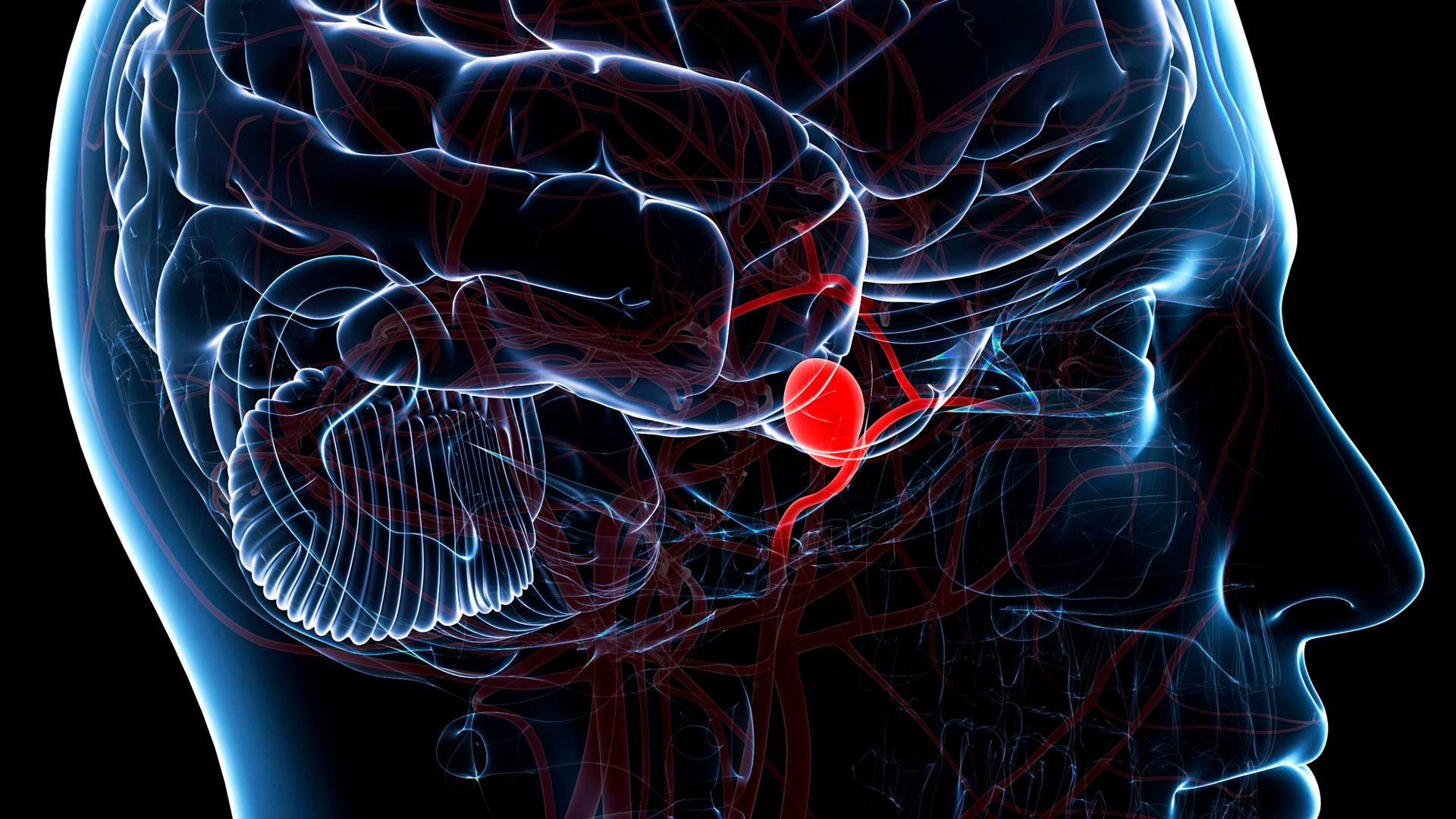 Brain and Vascular Health