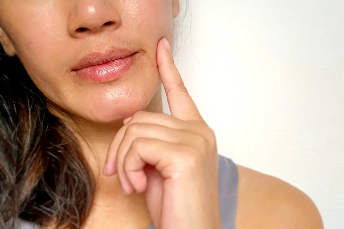 Apa yang Menyebabkan Bibir Kering?