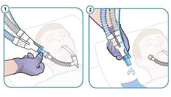 Positioning and maintenance of breathing circuit sets