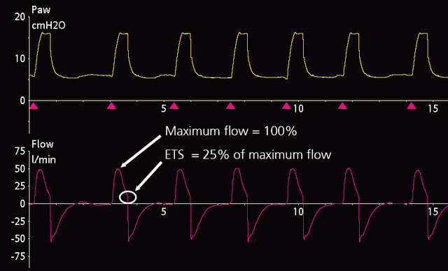 How to set expiratory trigger sensitivity (ETS)