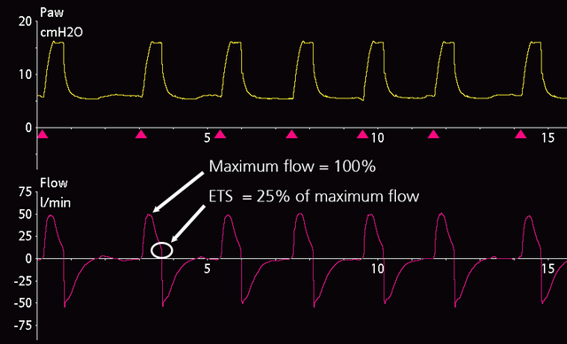 Screenshot of flow waveform indicating maximum flow and ETS at 25%