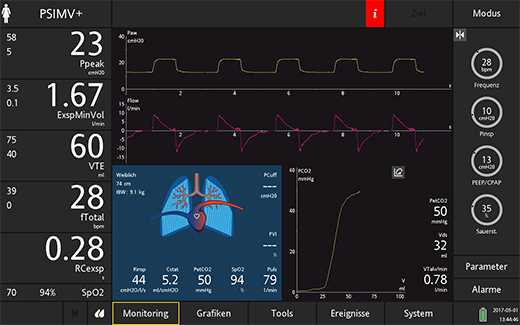 Screen showing monitoring parameters and waveforms