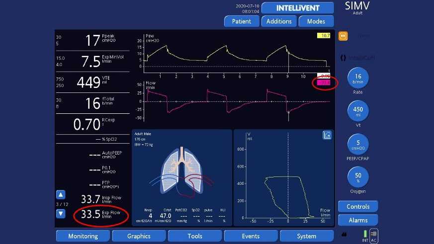 Screenshot showing exp flow value