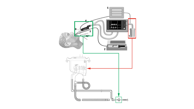 Use of AnaConDa with Hamilton Medical ventilators