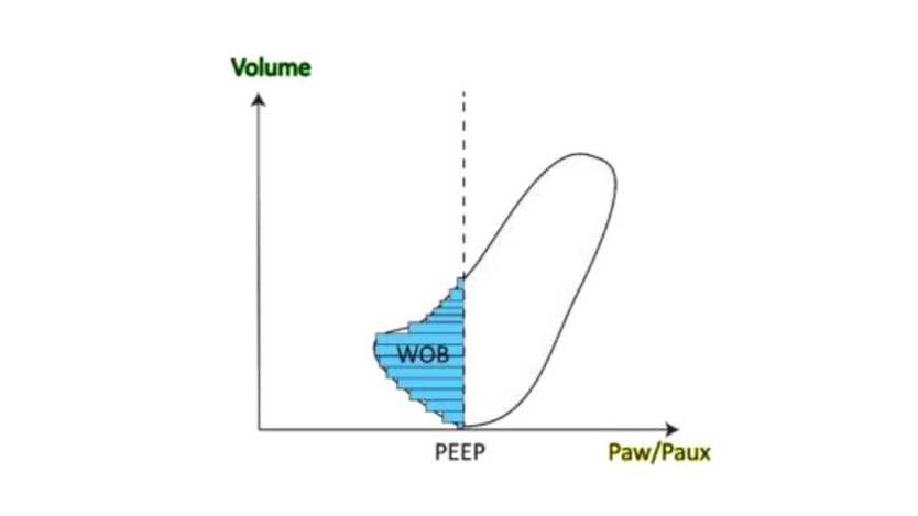 WOB pressure-volume loop