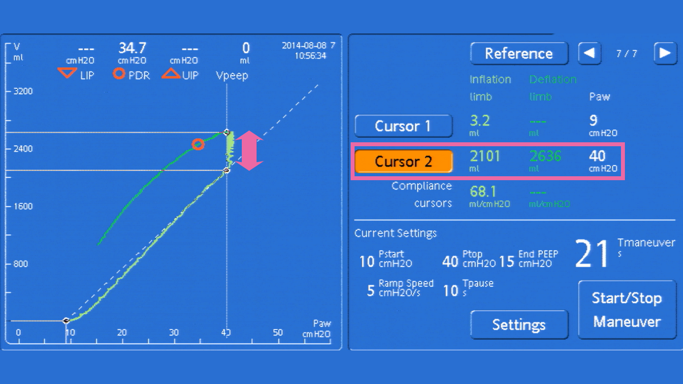 Screenshot showing loop and volume increase