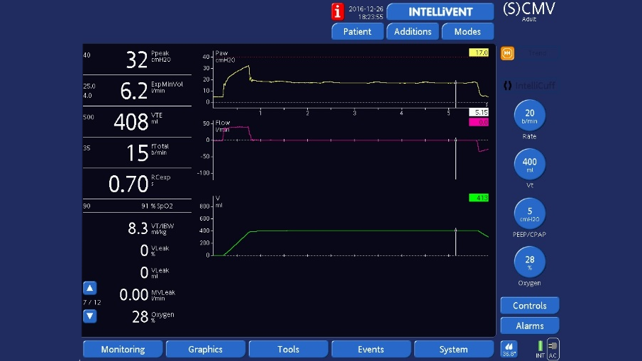 Screenshot ventilator display showing end-inspiratory hold in volume control