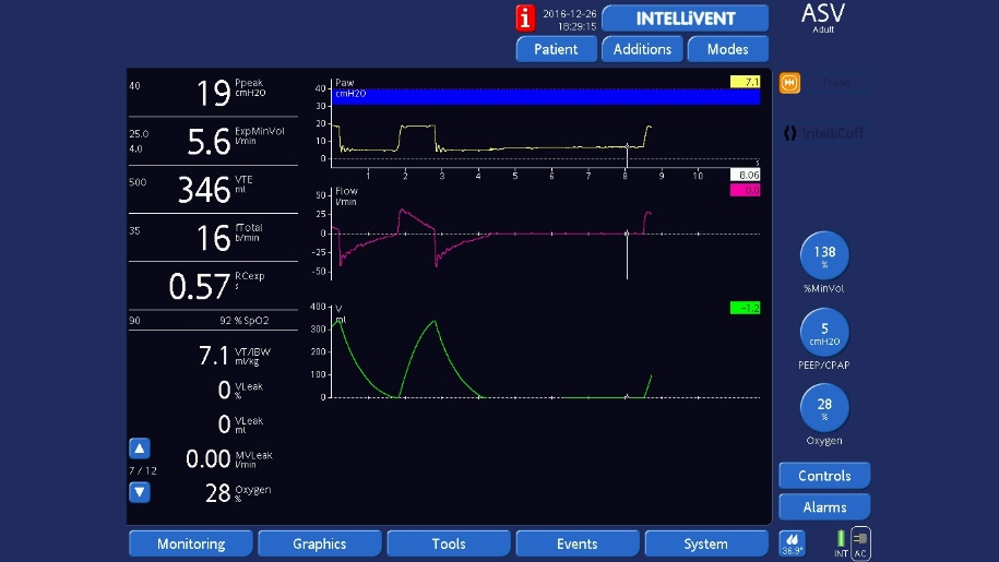 Screenshot ventilator display showing end-inspiratory hold in ASV mode