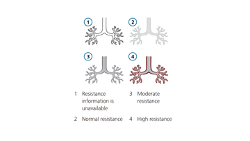 Graphic illustration: Dynamic lung resisttance