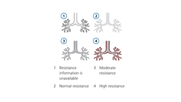 Grafische Darstellung: Resistance der dynamischen Lunge