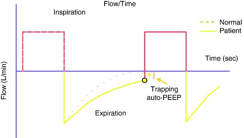 Flow-time graph showing AutoPEEP and air trapping