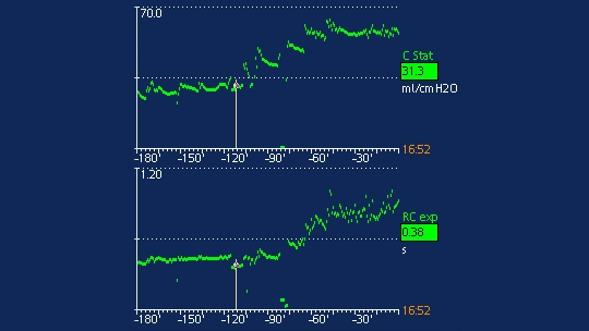 Screenshot showing increase in RCexp and compliance