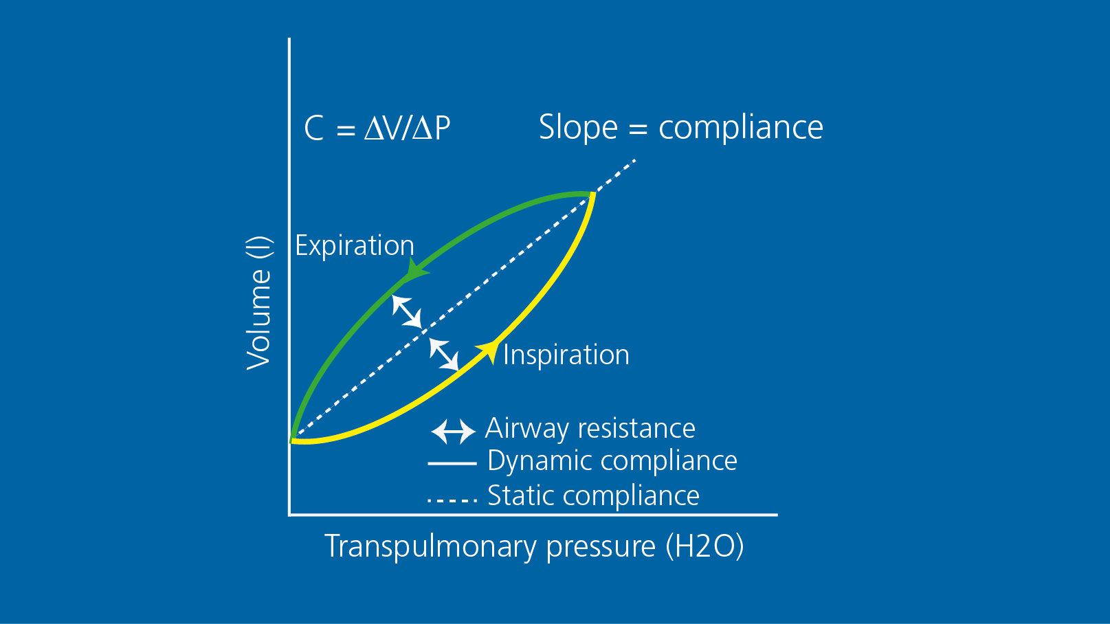 Diagramm mit Druck/Volumen-Loop