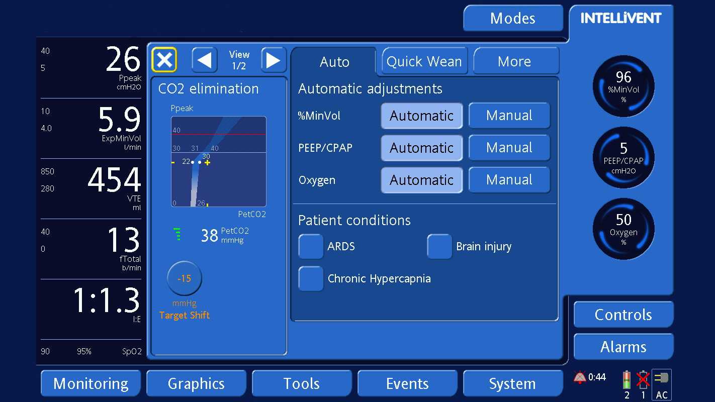 Screenshot des Displays mit Verschiebung des Zielbereichs um 15 mmHg nach links