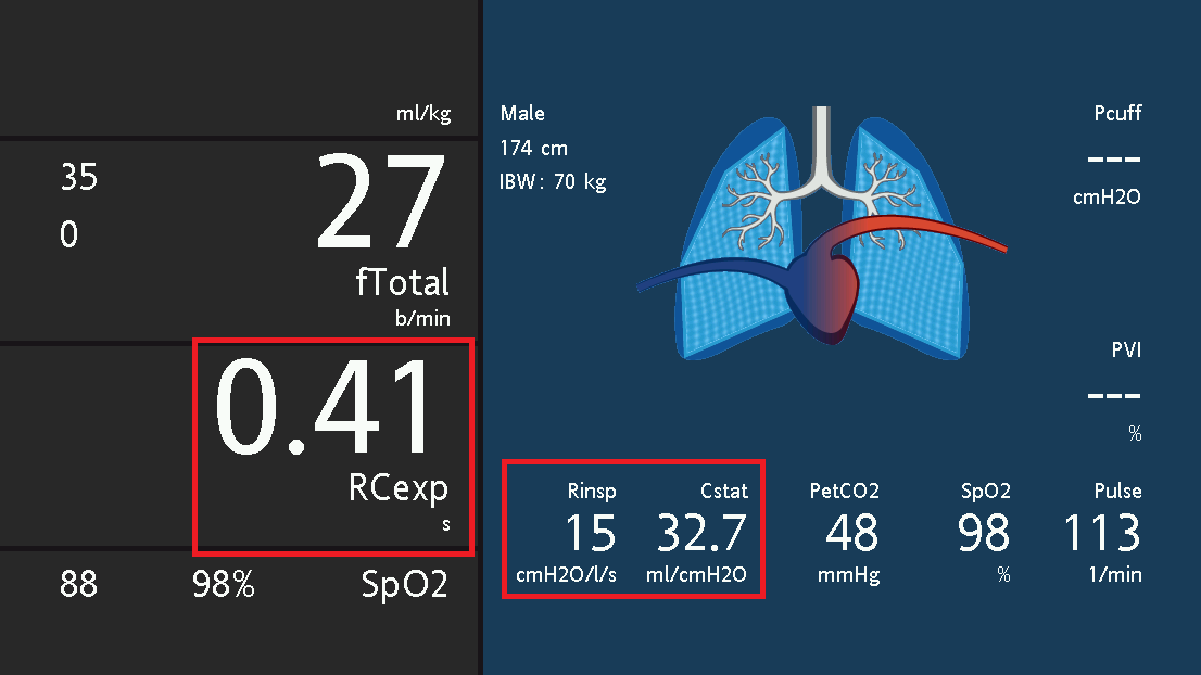 Screenshot of display showing RCexp of 0.41