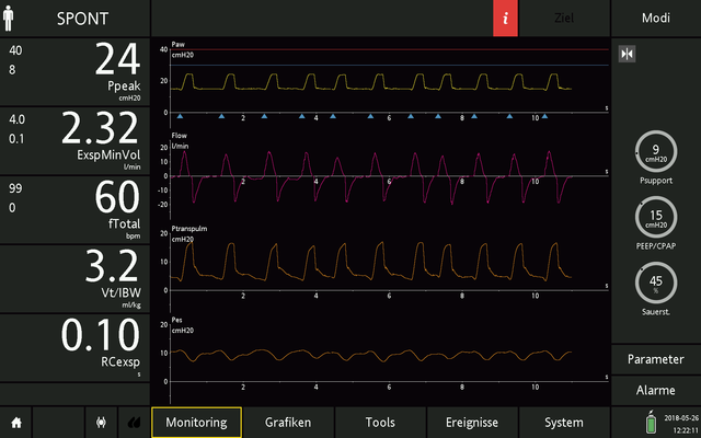 Screen showing monitoring parameters and waveforms