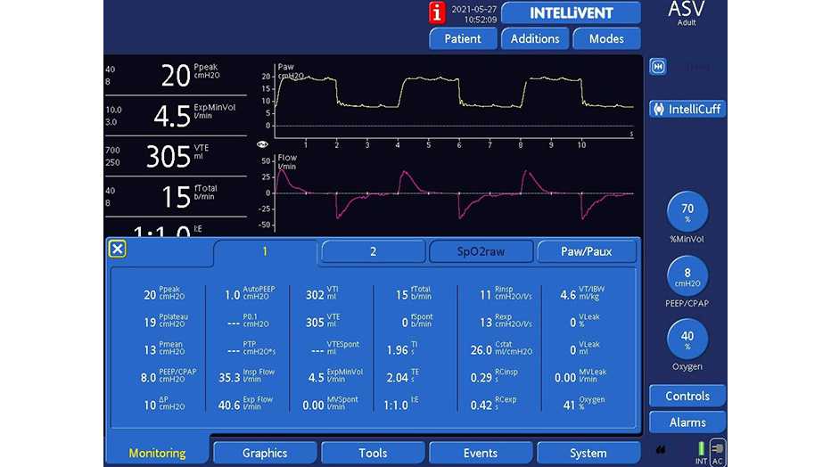 Display with all monitoring parameters