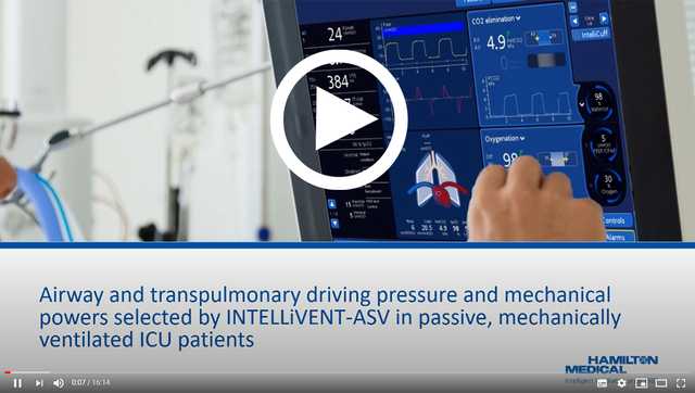 Journal Club: Driving pressure and mechanical powers selected by INTELLiVENT-ASV