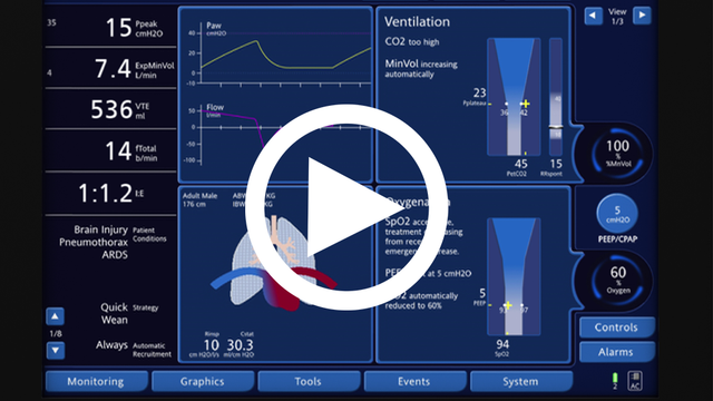 P04_INTELLiVENT-ASV_How_To_Video