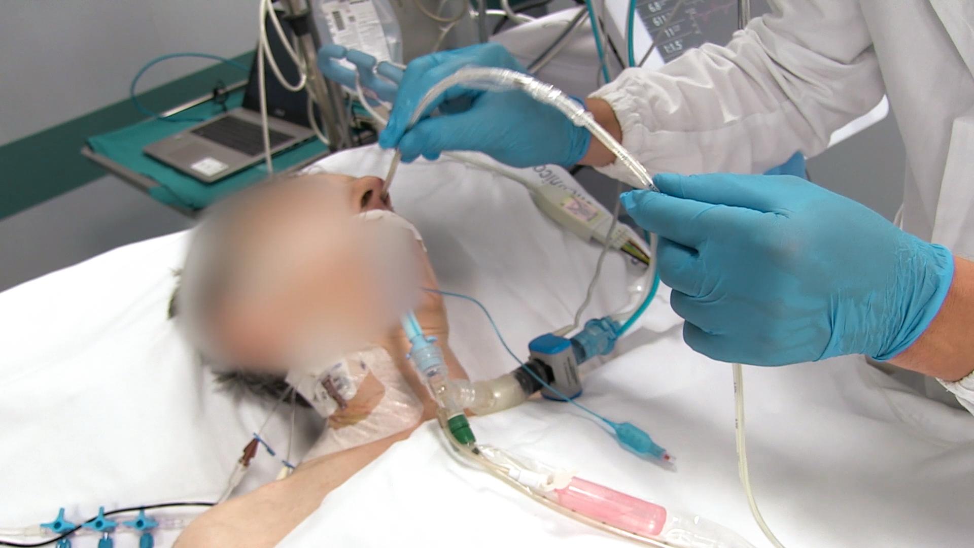 Inserting an esophageal balloon catheter into a patient