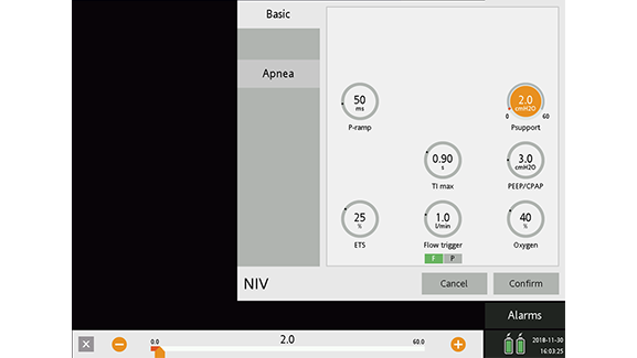 Screenshot showing settings for Psupport