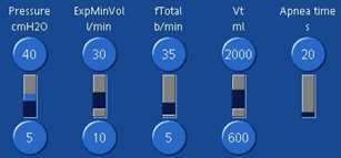 Screenshot of settings for Pressure, ExpMinVol, fTotal, Vt, and Apnea time