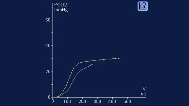 Снимок экрана с изображением нарастания CO2