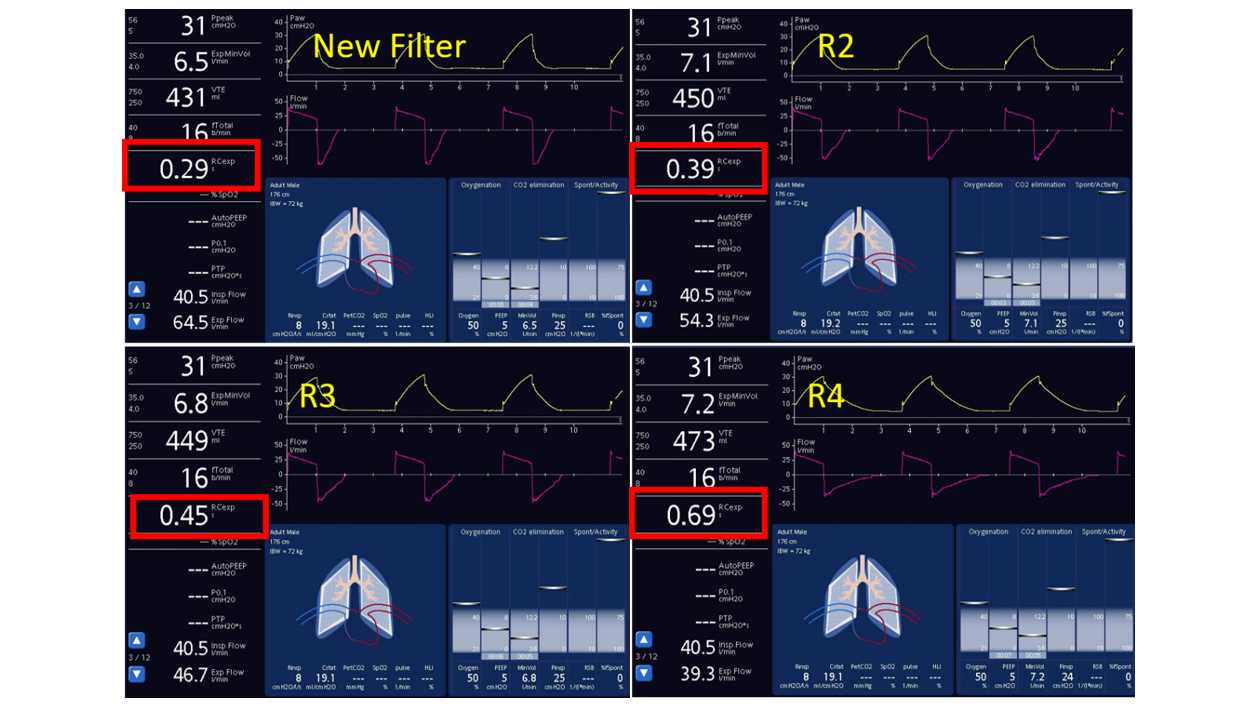 Screenshots showing dynamic lung and monitoring parameters