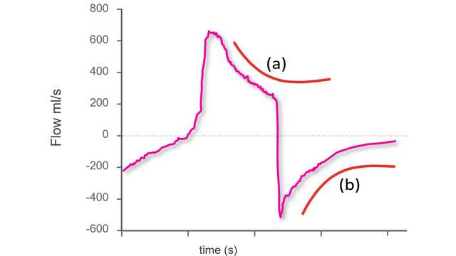 Using waveforms to indentify asynchronies - Step 1