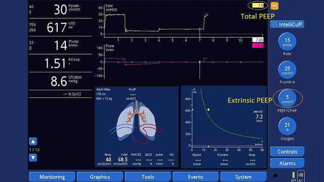 Measurement of AutoPEEP and total PEEP