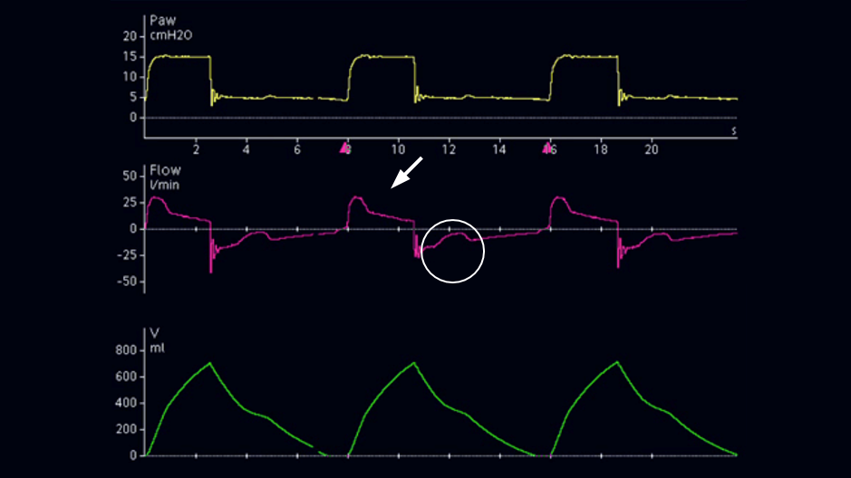 Screenshot of waveform showing change in flow