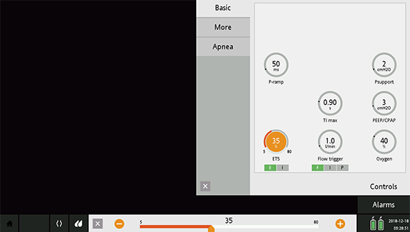 Screenshot showing settings for ETS