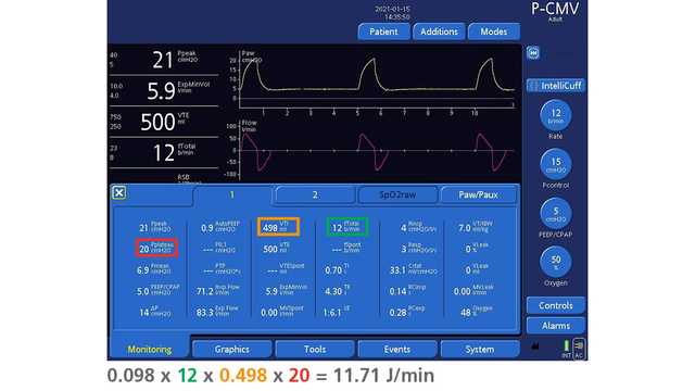 Screenshot showing relevant parameters for calculating MP in pressure control in monitoring window