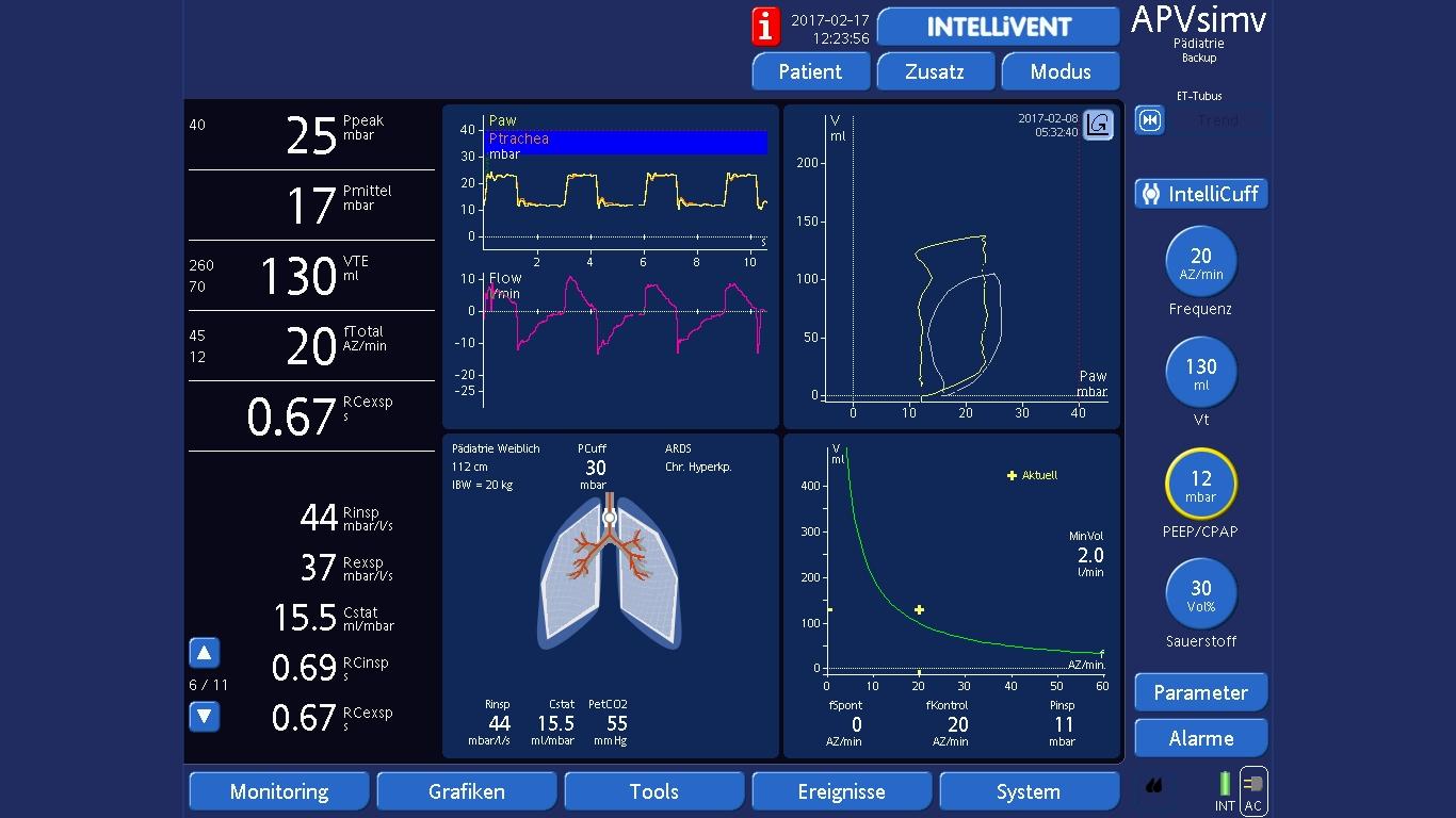 Screen showing monitoring parameters and waveforms