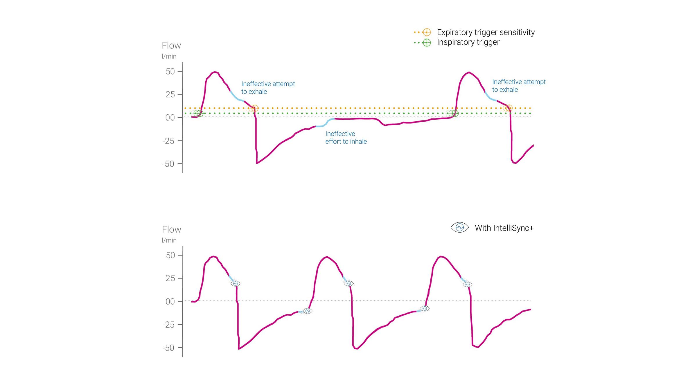 InelliSync before and after