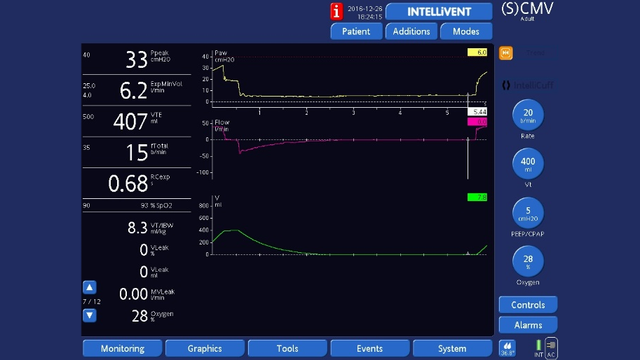 Screenshot ventilator display showing end-expiratory hold in volume-control