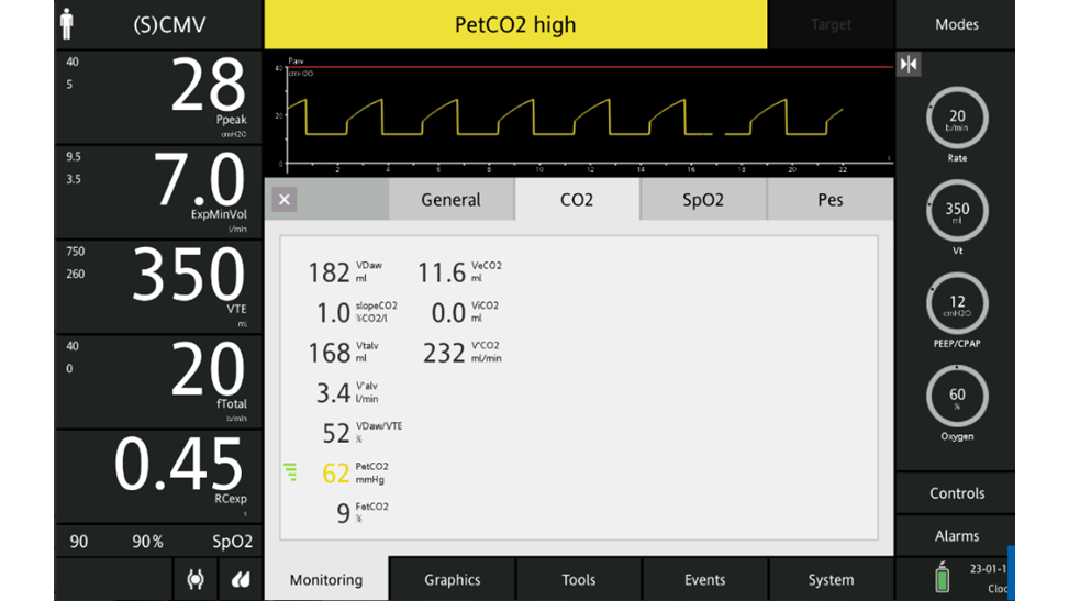 Achieving Effective Ventilation Using Volumetric Capnography