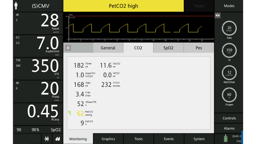 Schermata che mostra l'allarme del valore di PetCO2 alto