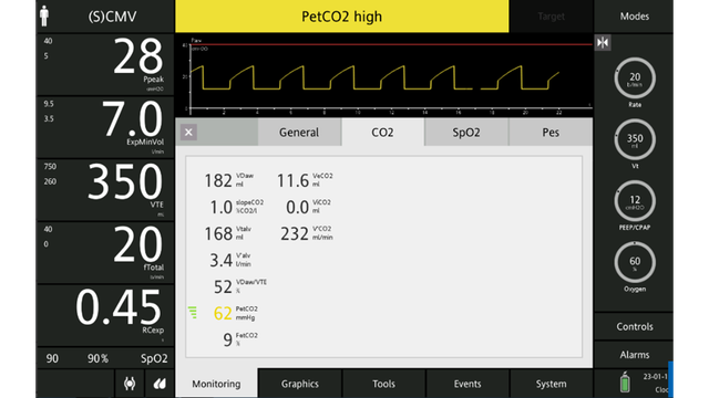 Screenshot mit Alarm „PetCO2 zu hoch“