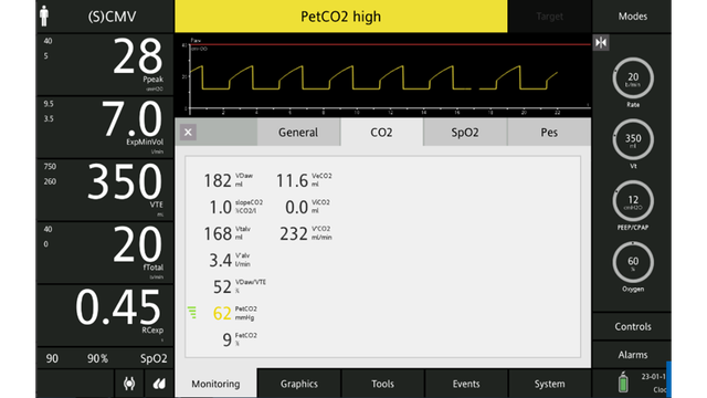Screenshot showing PetCO2 high alarm